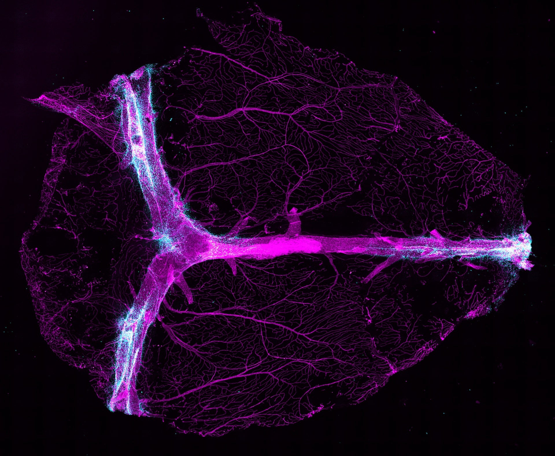 Signals carried in the cerebrospinal fluid (blue) are presented to immune cells in blood vessels (magenta) in the brain’s protective outer layers. 