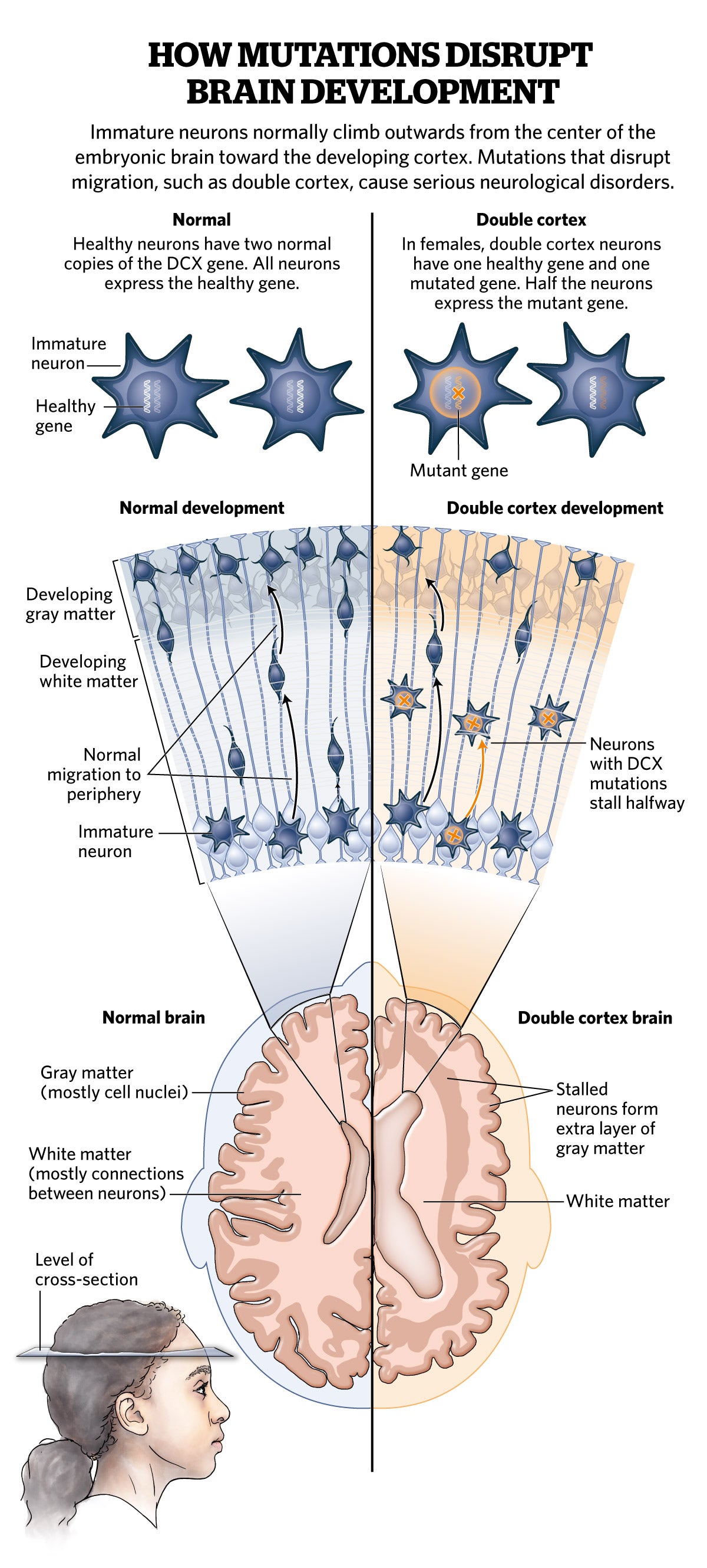 X chromosome exerts extra influence on brain development, Spectrum