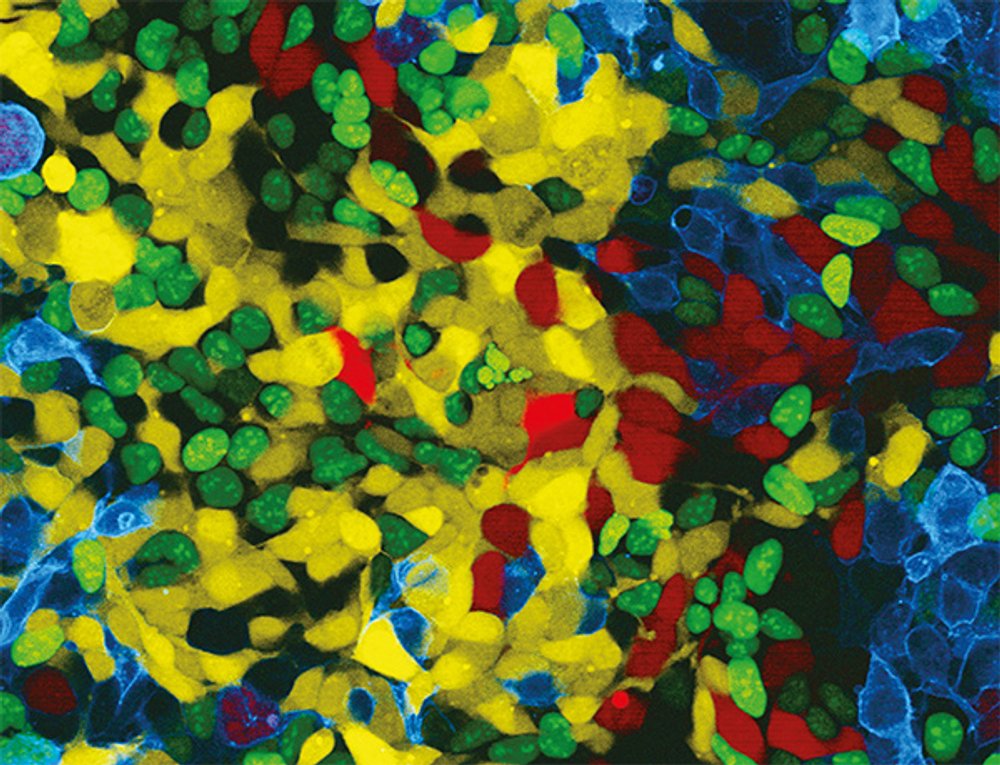 The Brainbow Connection: Viewing Nerve Cells in Living Color ...