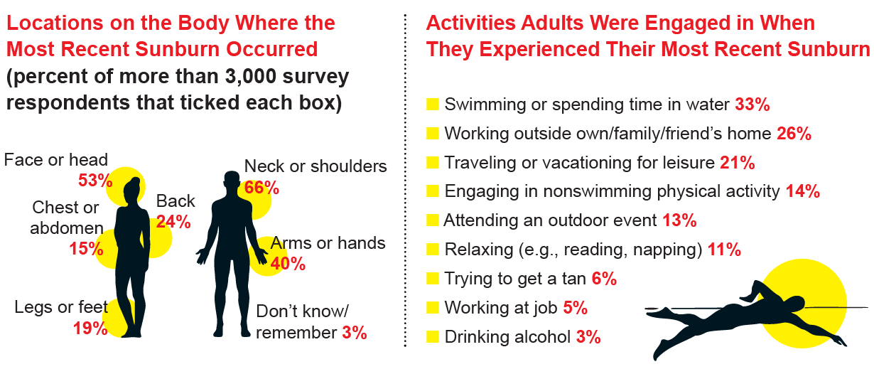 Graphics highlight most common body locations and activities associated with sunburn in the U.S.