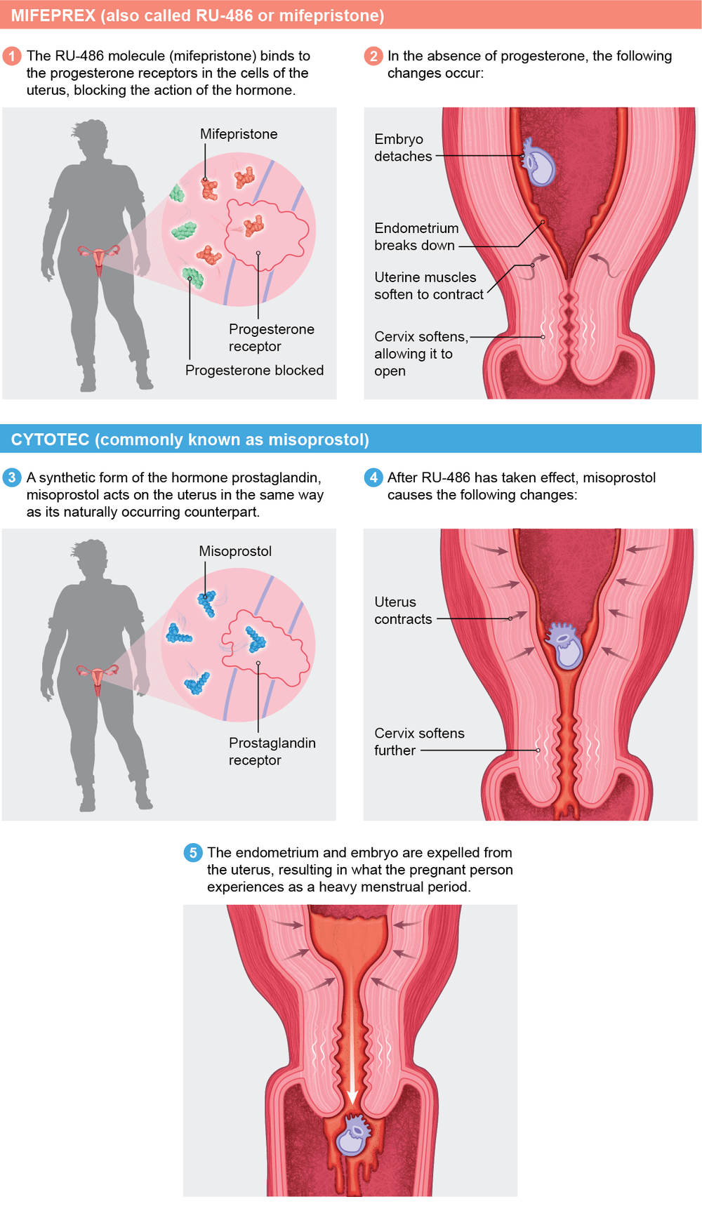 How Medication Abortion with RU-486/Mifepristone Works | Scientific ...