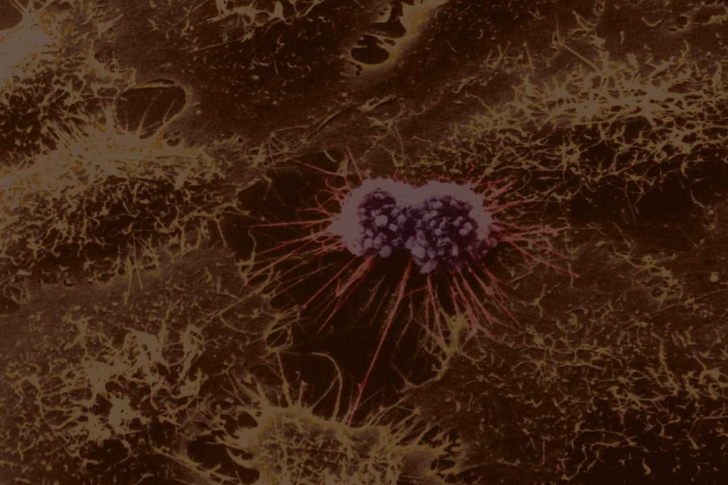 HeLa cells with Adenovirus, SEM