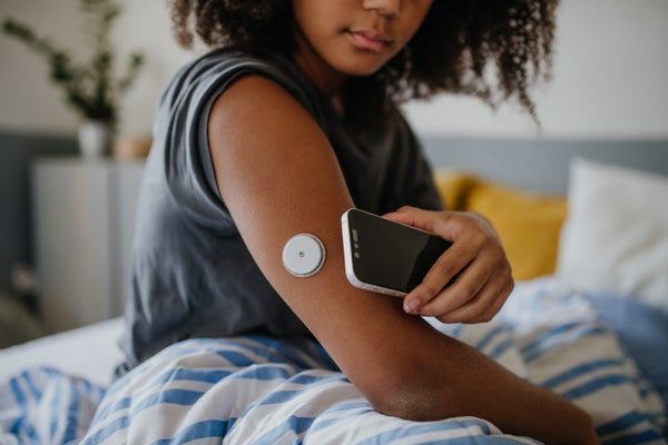 Teenage girl connecting smartphone to continuous glucose monitor, checking blood glucose while sitting in bed