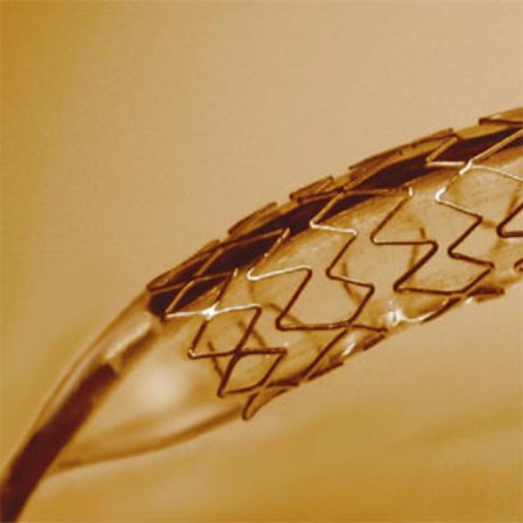 Next-Gen Heart Stents May Feature Toothlike Coating