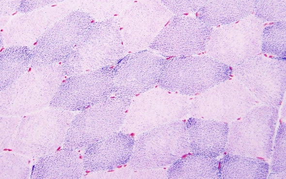 Mysterious Heat Spikes inside Cells Are Probed with Tiny Diamonds