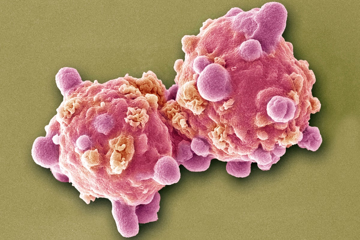Powerful Childhood Cancer Treatment Holds Promise--and Poses Hazards ...