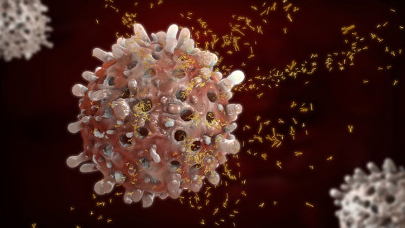 Immune Secrets of Lupus Unveiled