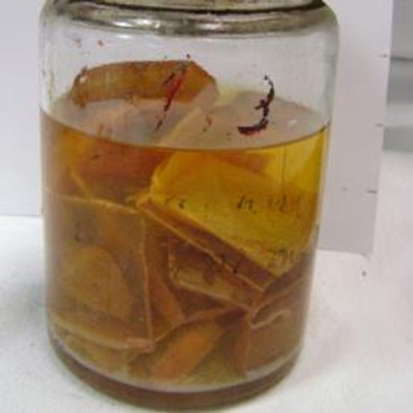 Shelf-Preservation: Researchers Tap Century-Old Brain Tissue for Clues to Mental Illness