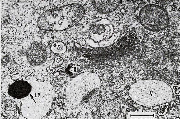 Biology 101 Update A Cell Rsquo S Lysosomes Are More Than Garbage Disposals Scientific American Biology 101 Update A Cell Rsquo S Lysosomes Are More Than Garbage Disposals Scientific American