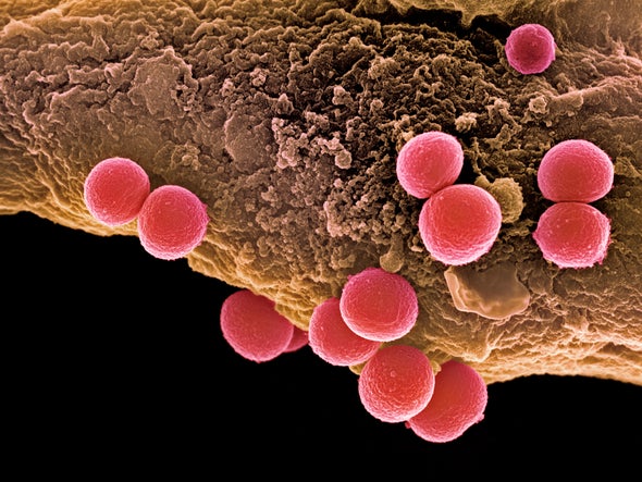 Mind the Staph: London Is Crawling with Antibiotic-Resistant Microbes
