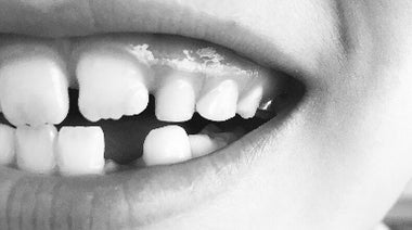 In Teeth, Markers of Disease