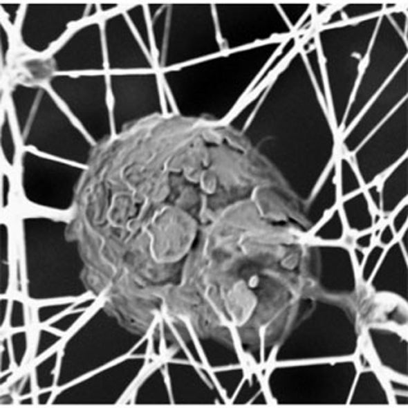 Nanotech to Regrow Cartilage and Soothe Aching Knees