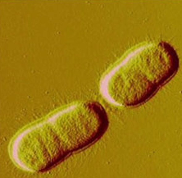 Dangerous New Antibiotic-Resistant Bacteria Reach U.S.