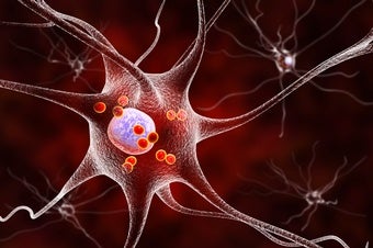 Mustering a Cell's Internal Defenses Might Hold Potential for New Parkinson's Disease Therapies