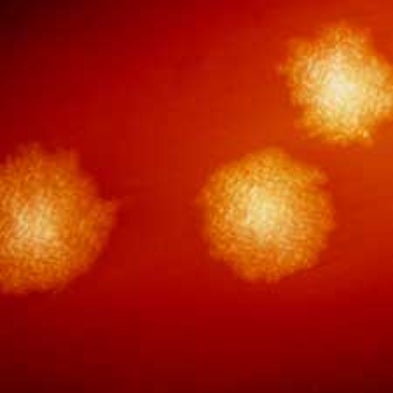Genetics in the Gut: Intestinal Microbes Could Drive Obesity and Other Health Issues