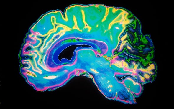 Pregnancy Primes the Brain for Motherhood