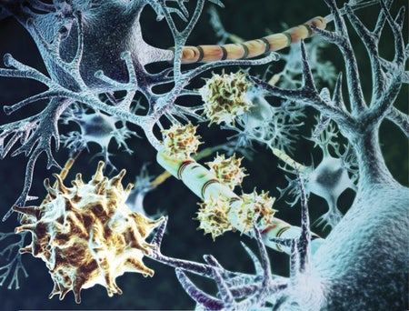 myelin under attack
