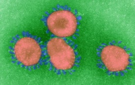 How Coronaviruses Cause Infection--from Colds to Deadly Pneumonia