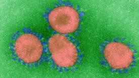 How Coronaviruses Cause Infection--from Colds to Deadly Pneumonia