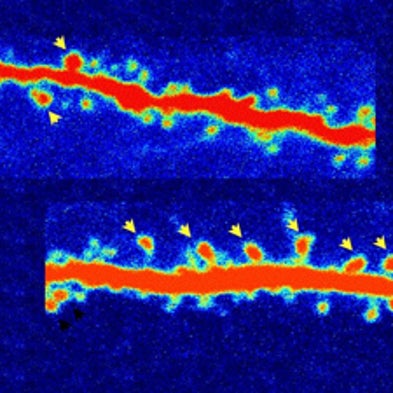 Psychedelic Drugs Show Promise as Antidepressants