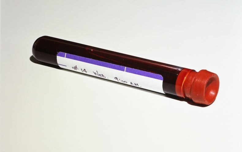 what blood test detects cancer