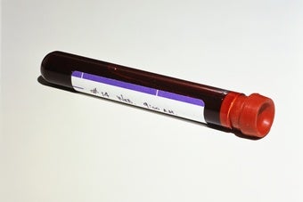 Blood test vial