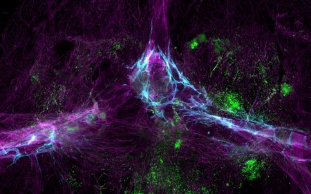 脑免疫系统包括运输容器网络(蓝)和骨髓内自生免疫细胞(绿色)。