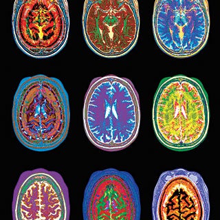 Five Ways Brain Scans Mislead Us | Scientific American