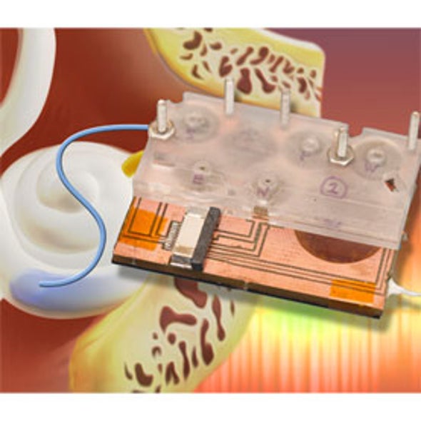 Exotic Micropumps and Gels Offer Hope for Hearing Disorders