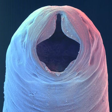 human parasite holes in skin