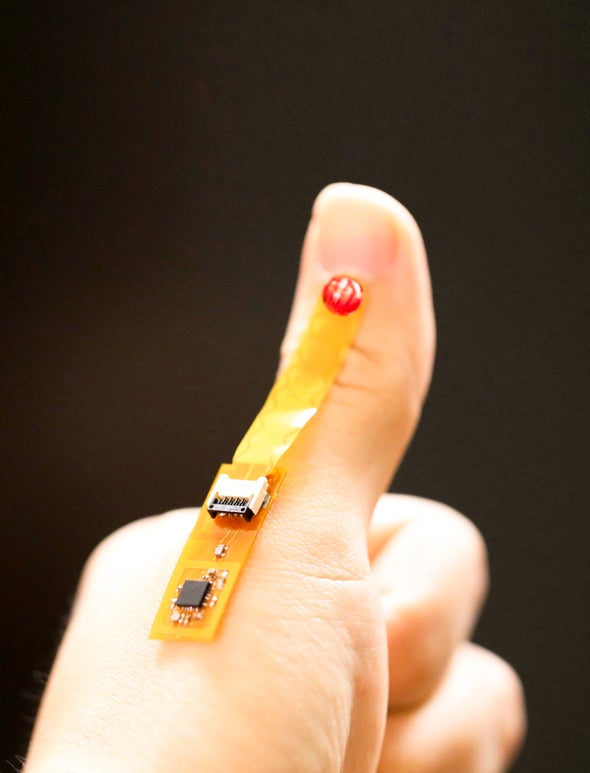 Gel-Based Sensor Continuously Monitors Wounds for Infection