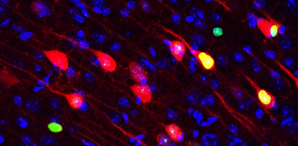 Where Does the Brain Store Long-Ago Memories? | Scientific American