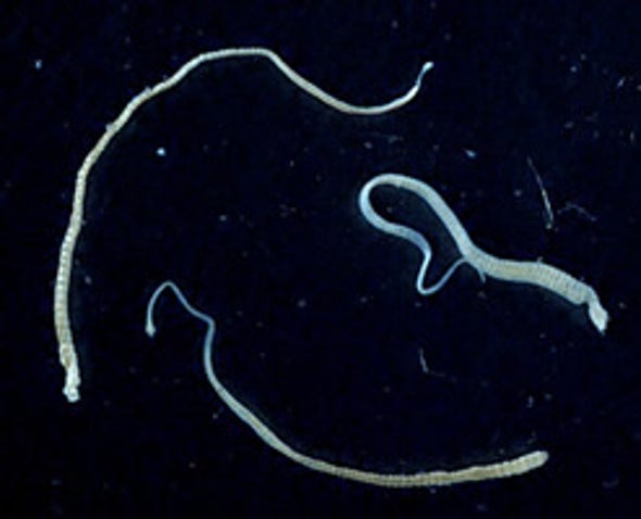 Images tape worm Human Intestinal