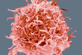 Immune-Cell Pioneers Win Prestigious Lasker Medical Award