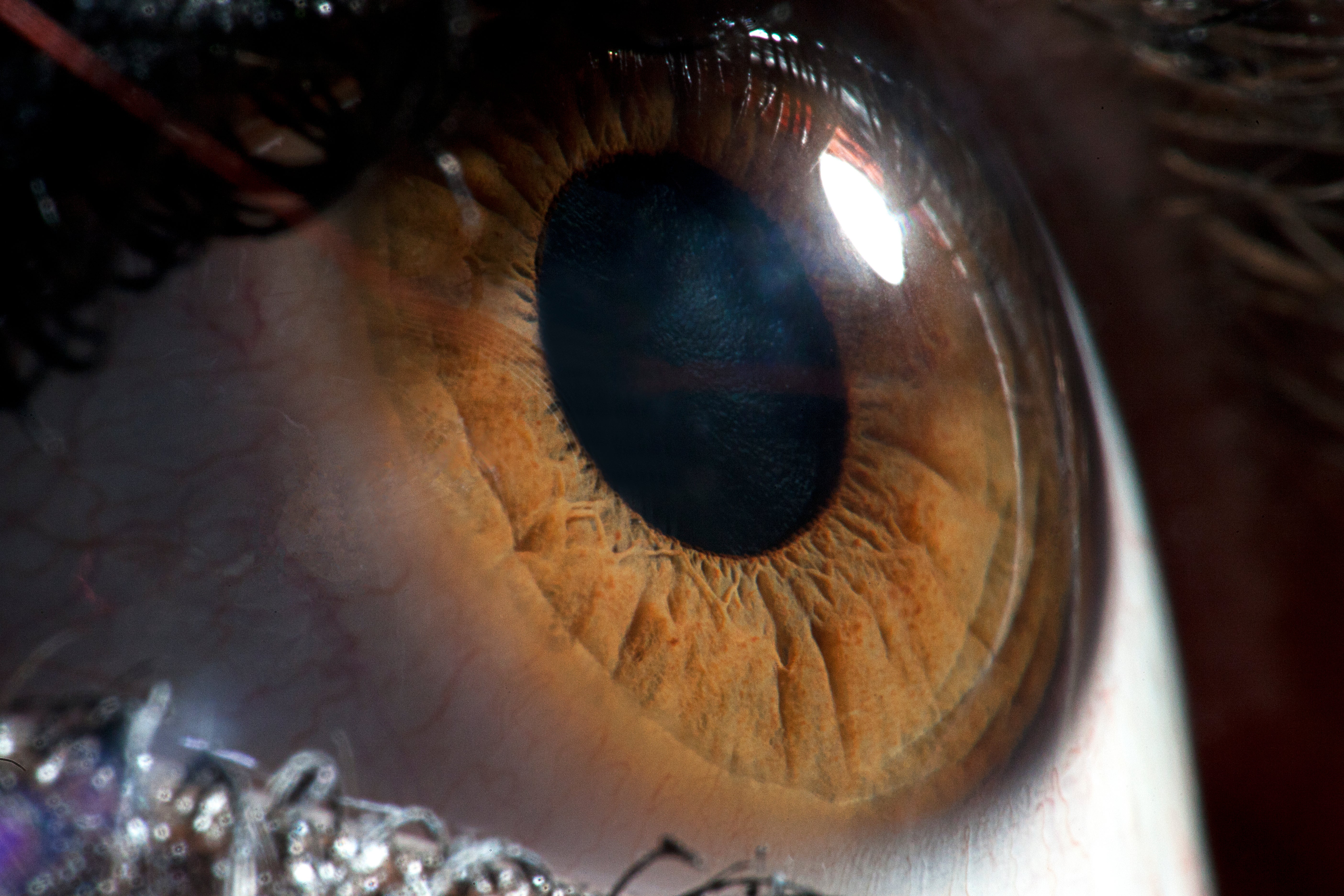 Human cornea.