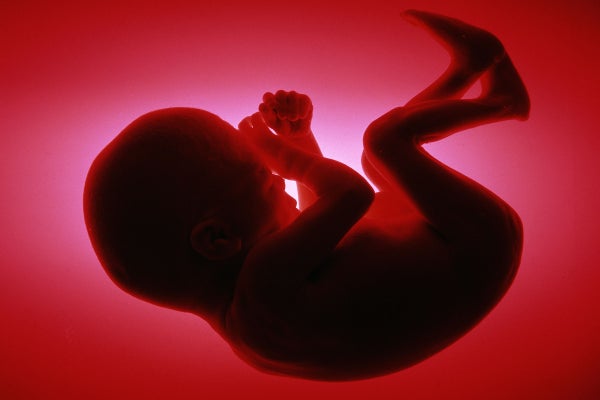 Five month old human fetus.