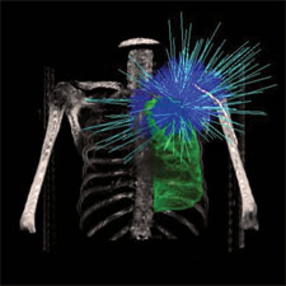 Cancer-Zapping Precision Radiation Beams Could Soon Target Other Diseases
