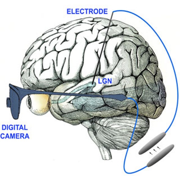 Scientists Set Sights on an Implantable Prosthetic for the Blind
