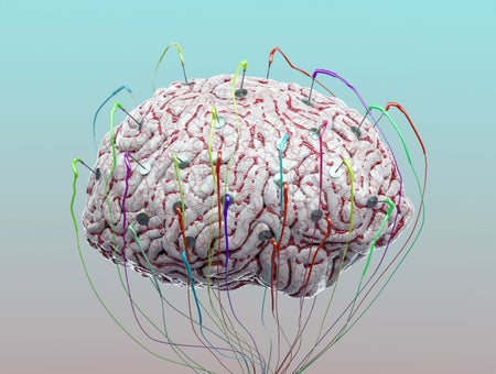 Illutration of a human brain suspended in mid air connected to wires and sensors.