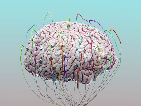 Illutration of a human brain suspended in mid air connected to wires and sensors.
