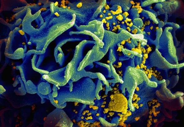 Antibody Infusions Provide Long-Term Defense against HIV-Like Infection