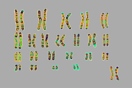 Human Karyotype