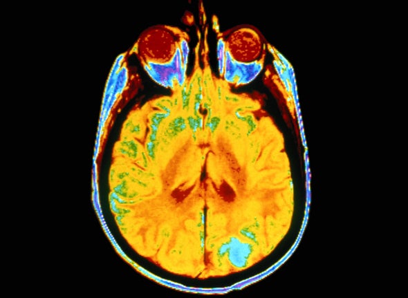 New Evidence Points to Personal Brain Signatures