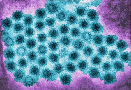 A micrograph showing the norovirus.