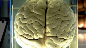 Brains in a Jar May Help Fight Disease [Video]