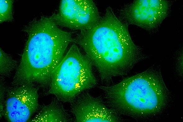Inhaled RNA Might Help Heal Cystic Fibrosis