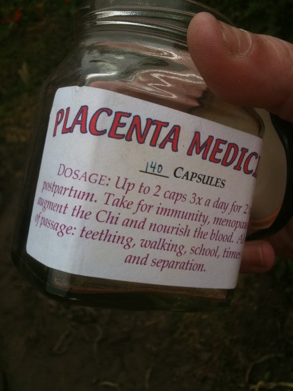 Mothers Who Eat a Newborn’s Placenta May or May Not Benefit