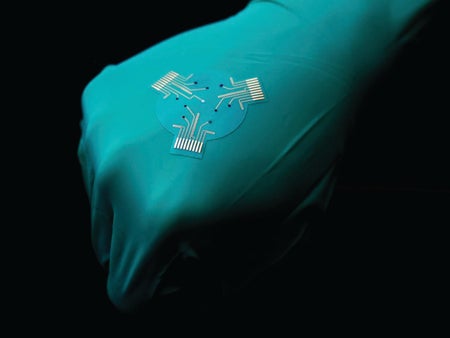 A "smart bandage" on a hand covered by a blue glove.