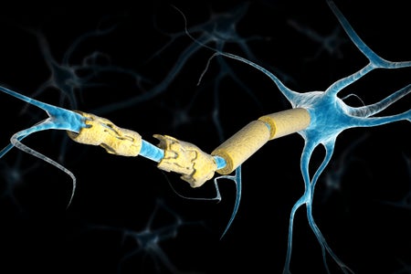 3-D rendering of a frayed neuron.