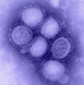 <b>The H1N1 Pandemic</b>